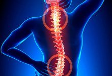 Photo of Mal di schiena: tipi, sintomi, trattamento, opinioni dei medici